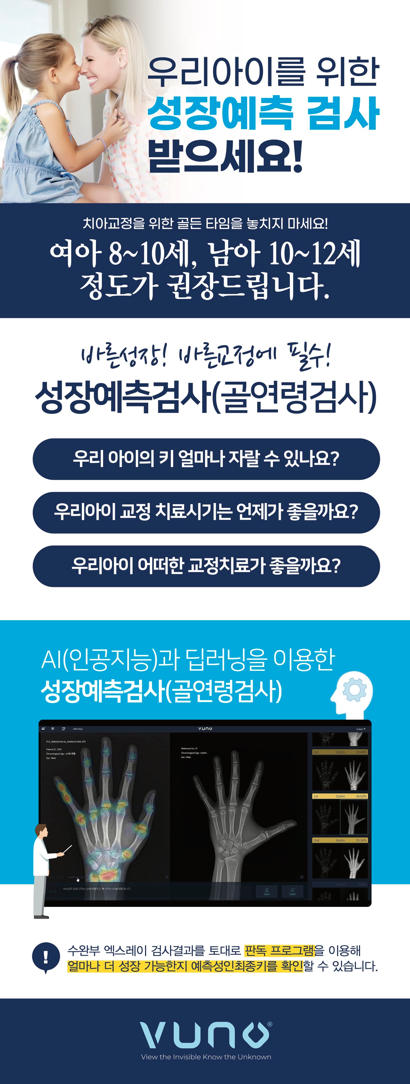 뼈나이 검사 섹션 이미지