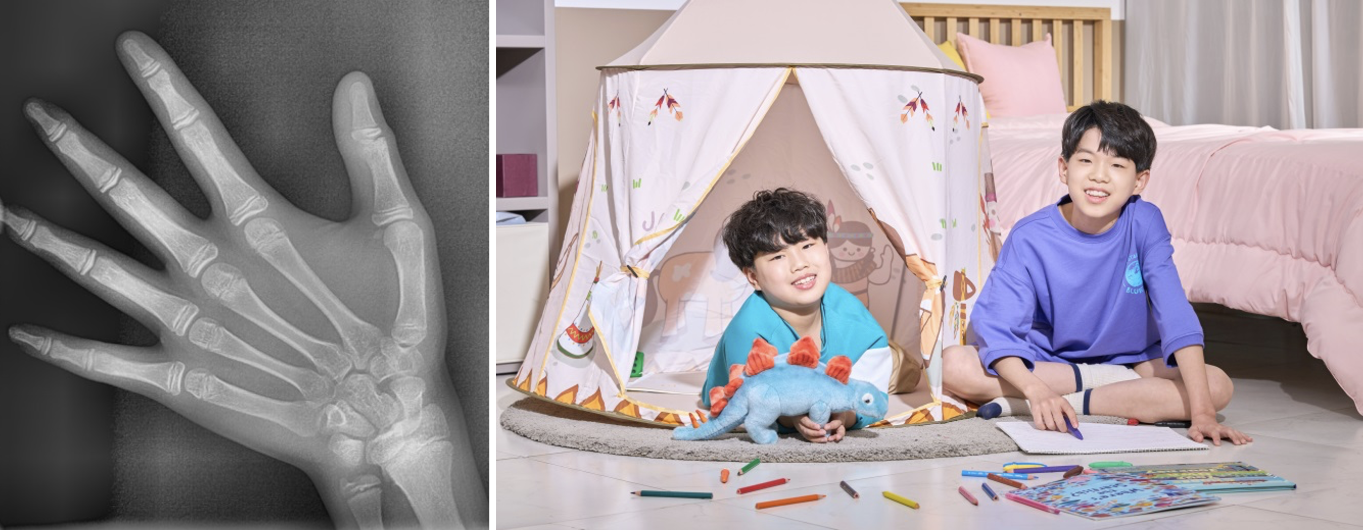 소아청소년교정 배경
